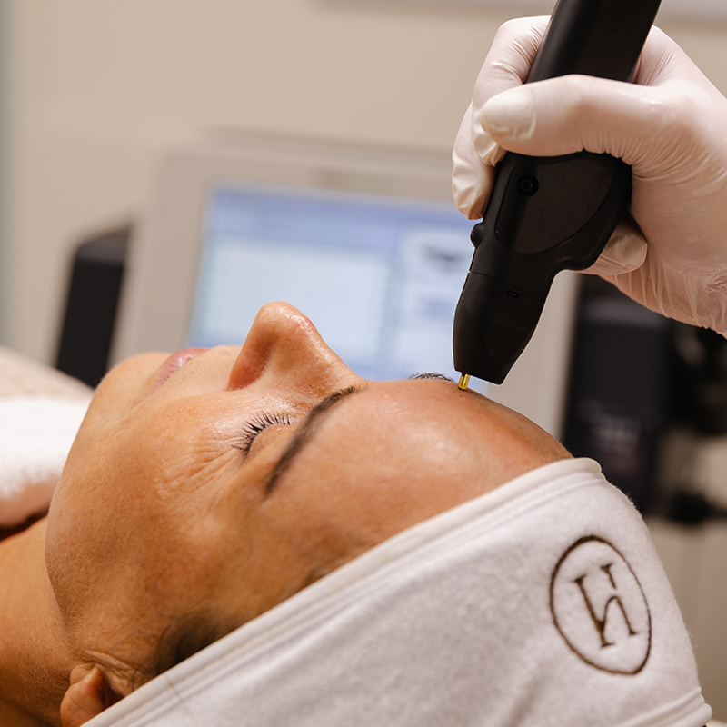 Behandeling bij Huidkliniek Parkstad