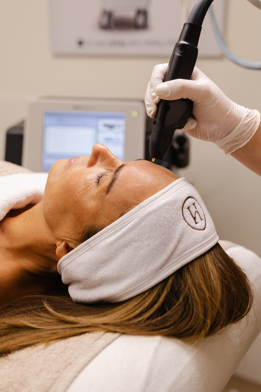 NeoGen Plasma behandeling op het voorhoofd